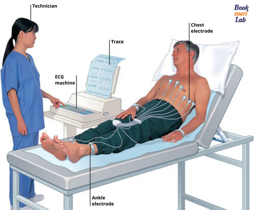 ECG CENTRE CALL 8147282686